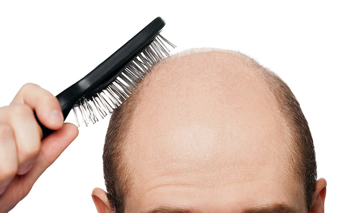выпадение волос у мужчин