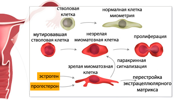 Схема развития миомы 