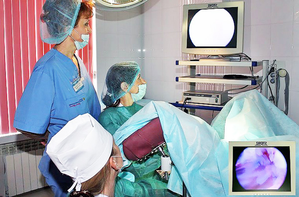 Операция гистерорезектоскопии проводится под общей анестезией