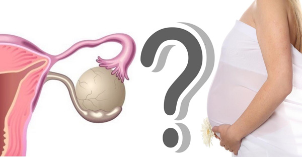 Посмотрим, возможна ли полноценная беременность на фоне фолликулярной кисты яичника...