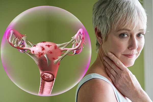 Рассматриваем особенности лечения эндометриоза у женщин после 40 лет...