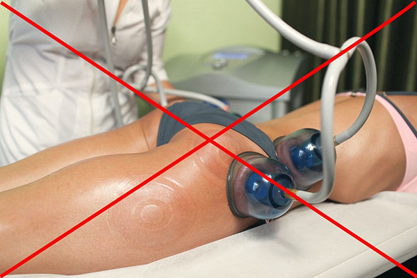 Запрет на вакуумный массаж при эндометриозе