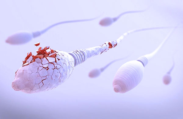 Гибель сперматозоидов во влагалище женщины при эндометриозе