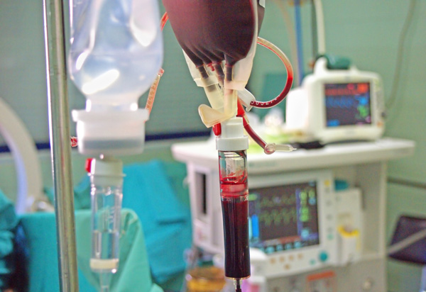 Переливание крови во время операции при разрыве кисты с кровоизлиянием