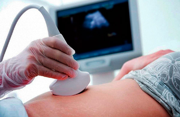 УЗИ органов малого таза при беременности на фоне кисты