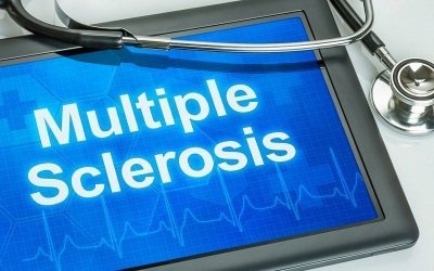 Лечение рассеянного склероза стволовыми клетками: когда требуется?