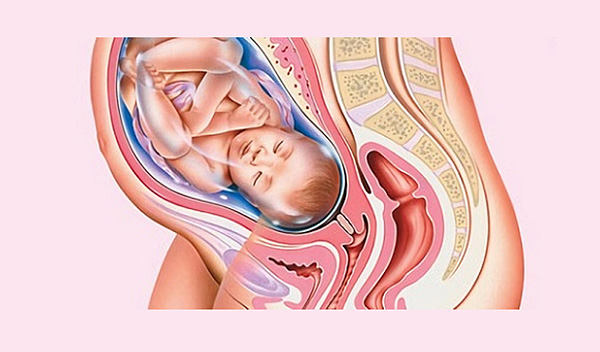 Часто после родов возникает эктропион шейки матки