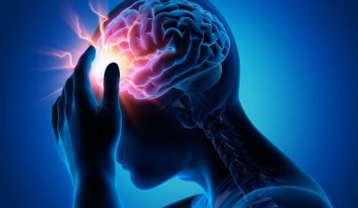 Парциальная эпилепсия: особенности и код по МКБ-10