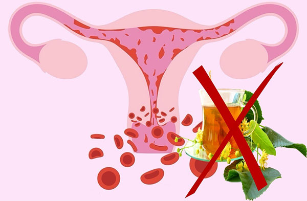 При обильных менструациях, вызванных аденомиозом, фитотерапия противопоказана